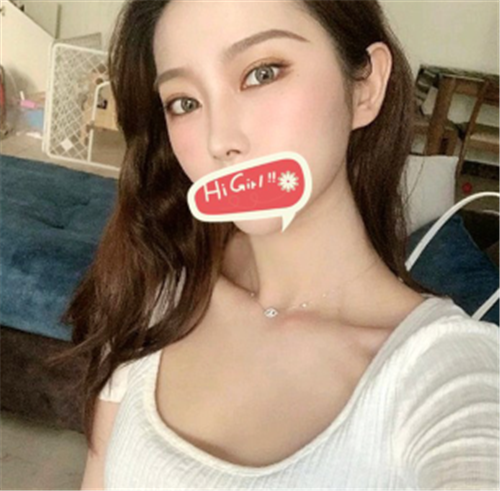 北京克莱美舍割双眼皮怎么样?案例,价格