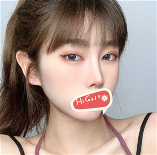 北京克莱美舍割双眼皮怎么样?案例,价格