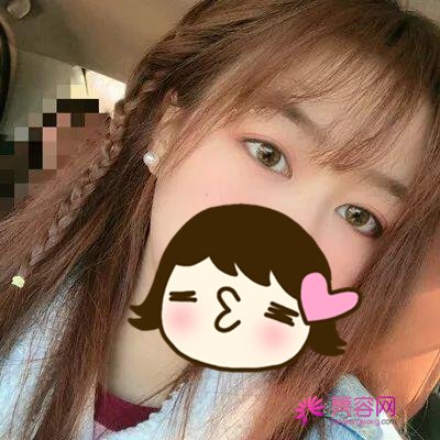 北京伊美尔秦宏伟做双眼皮手术怎么样？案例,价格,口碑