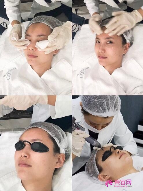兰州海惠马爱红做面部除皱手术怎么样？案例,价格,口碑