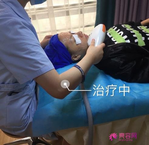 唐山苏亚美联臣金日炫做激光祛斑怎么样？案例_价格_口碑