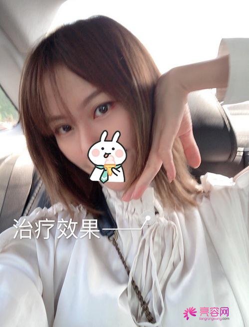 唐山苏亚美联臣金日炫做激光祛斑怎么样？案例_价格_口碑