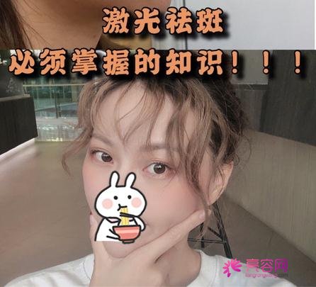 唐山苏亚美联臣金日炫做激光祛斑怎么样？案例_价格_口碑