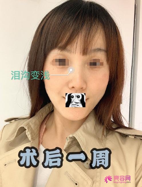 嘉兴曙光金瑶做热玛吉怎么样？案例_价格_口碑