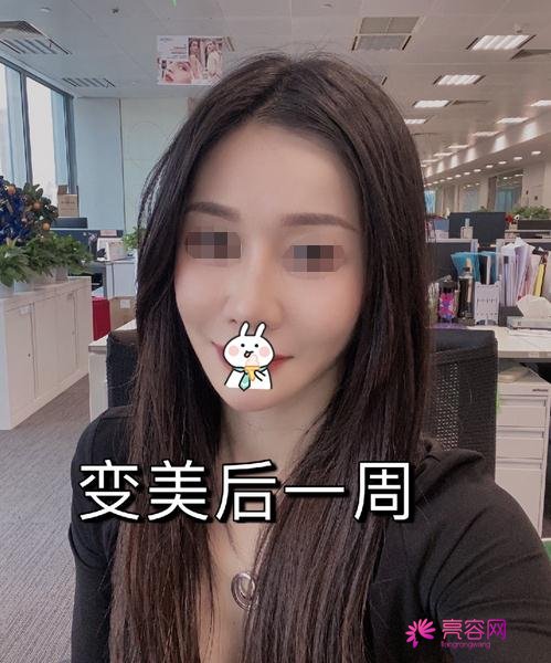 嘉兴曙光金瑶做热玛吉怎么样？案例_价格_口碑