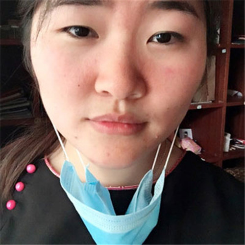 吴海龙割双眼皮怎么样?案例,价格