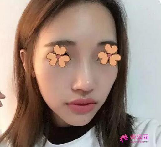 北京煤医庄洪兴做耳再造整形果怎么样？案例_价格_口碑