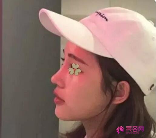 北京煤医庄洪兴做耳再造整形果怎么样？案例_价格_口碑