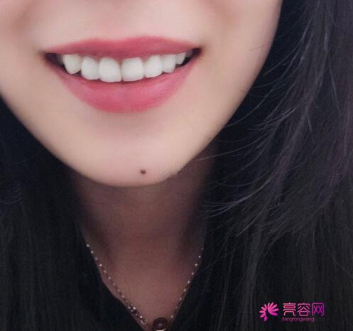 深圳正夫口腔严宁做牙齿种植怎么样?案例_价格_口碑