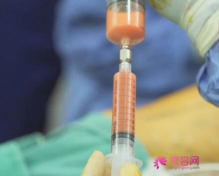 乌鲁木齐子桐整形李咏红做吸脂瘦身技术好不好？案例,价格,口碑