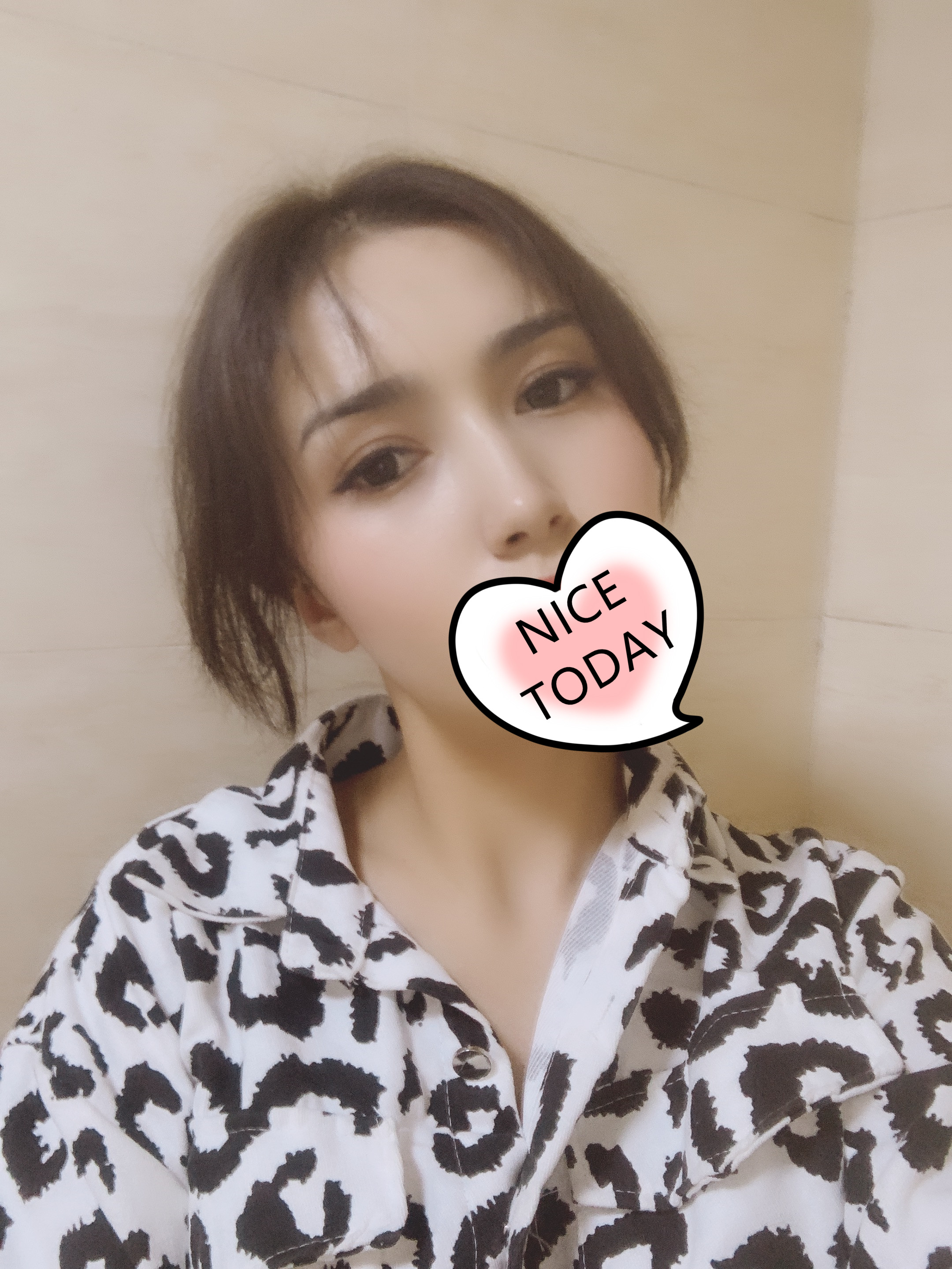 北京美莱谭章梅割双眼皮怎么样?案例,价格