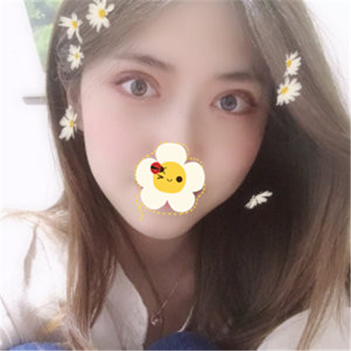 王瑾割双眼皮怎么样?案例,价格