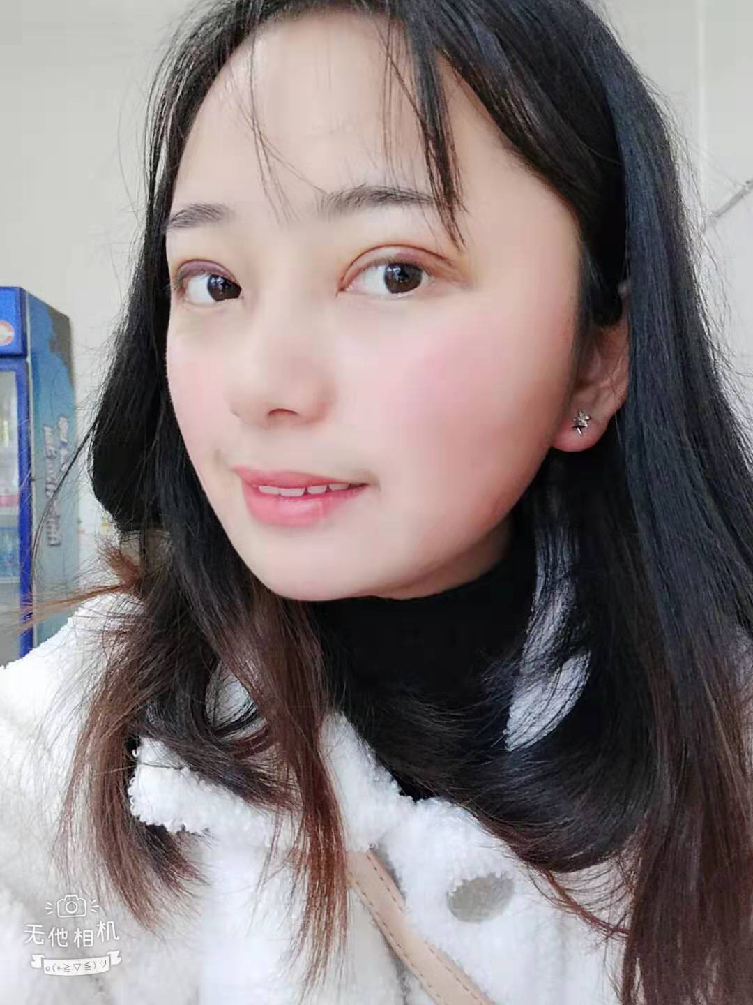 北京延世金奇龙割双眼皮怎么样?案例,价格