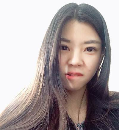 北京知音李文波割双眼皮怎么样?案例,价格