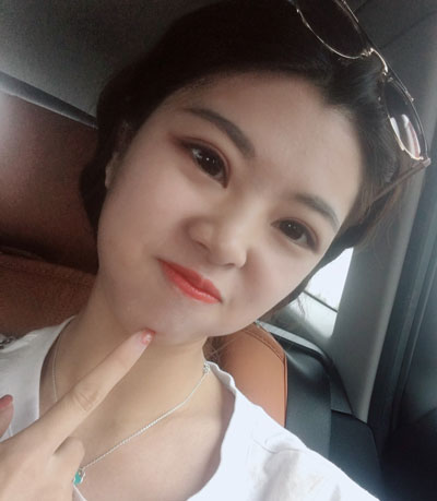 北京知音李文波割双眼皮怎么样?案例,价格