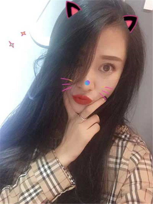 上海华美胡小清割双眼皮怎么样?案例_价格
