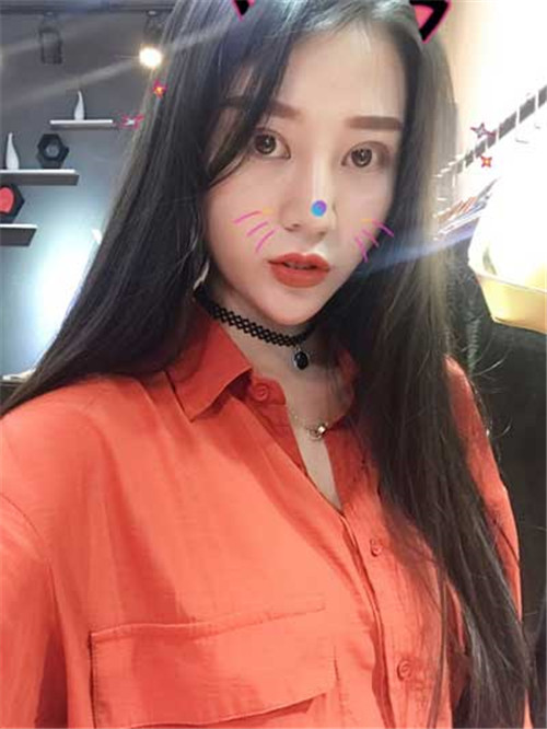 上海华美胡小清割双眼皮怎么样?案例_价格