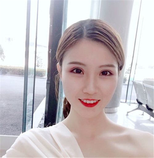 北京延世宋俊玲割双眼皮怎么样?案例,价格