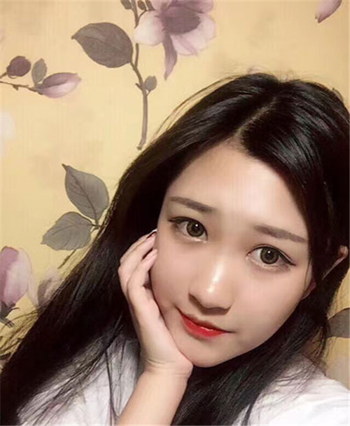 北京延世宋俊玲割双眼皮怎么样?案例,价格