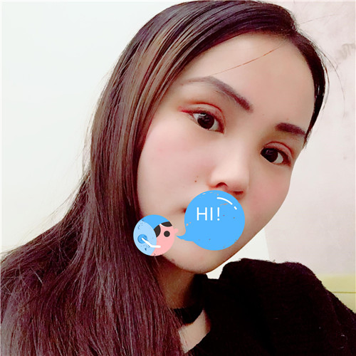 上海伯思立徐晓斐割双眼皮怎么样?案例,价格