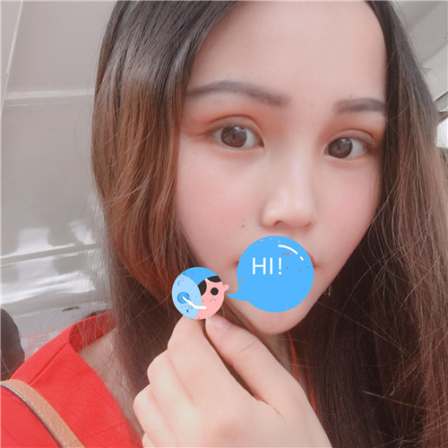 上海伯思立徐晓斐割双眼皮怎么样?案例,价格