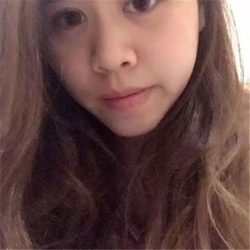 王琳隆鼻怎么样?案例,价格