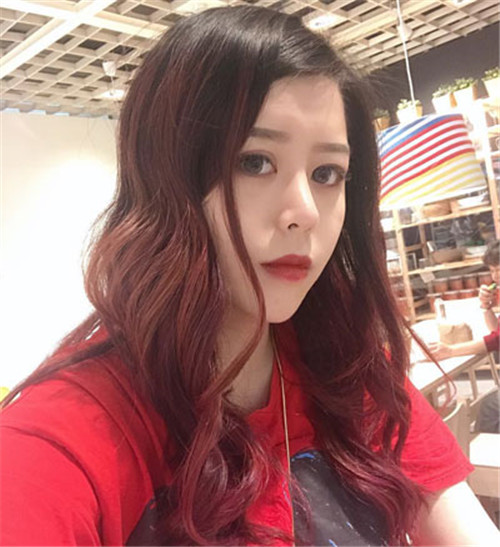 王琳隆鼻怎么样?案例,价格
