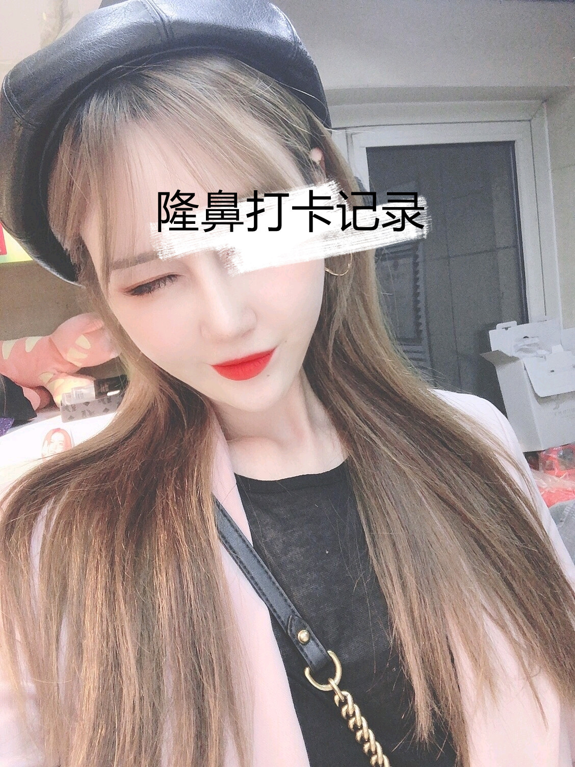 北京画美马群隆鼻怎么样?案例,价格