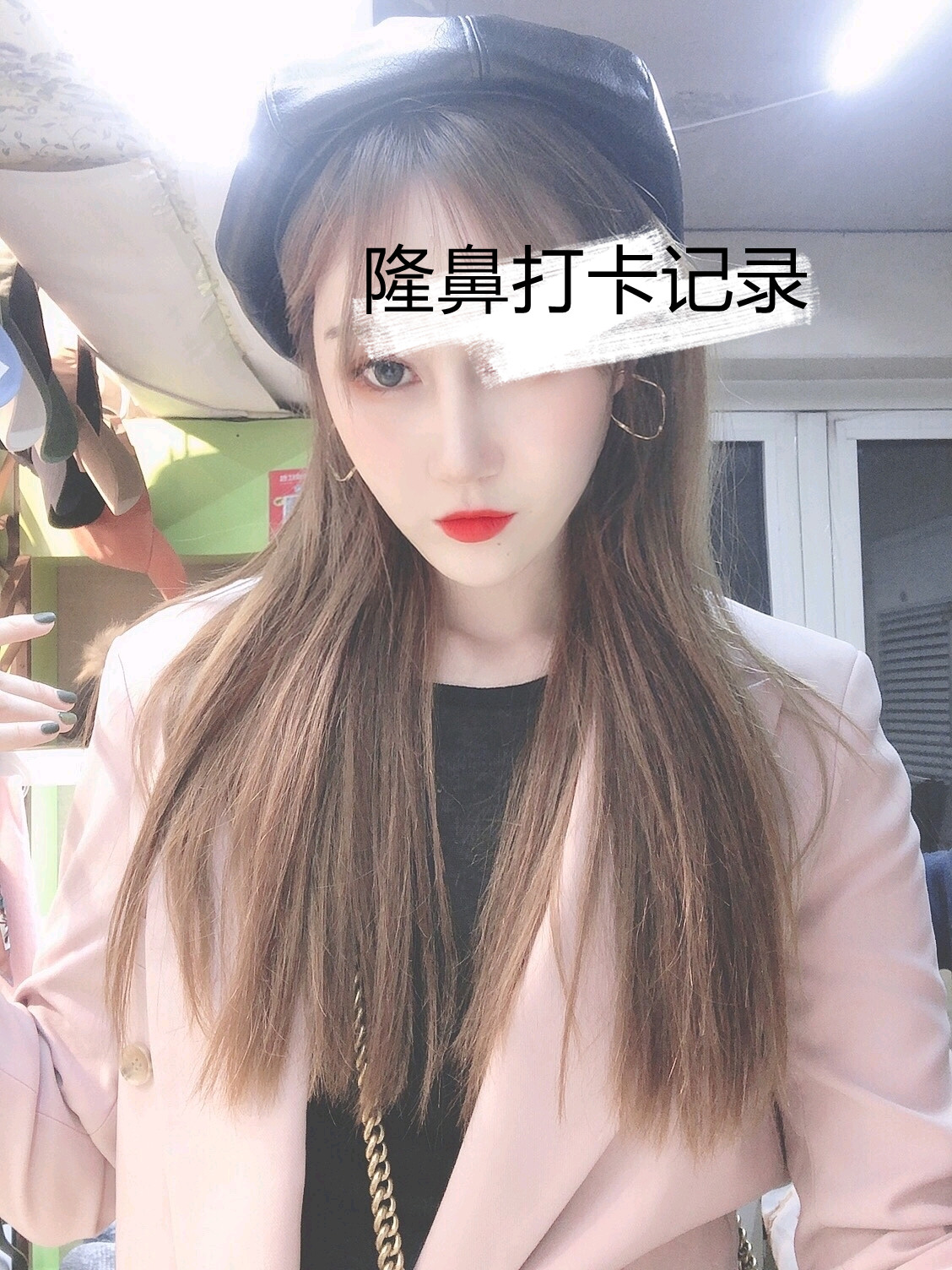 北京画美马群隆鼻怎么样?案例,价格