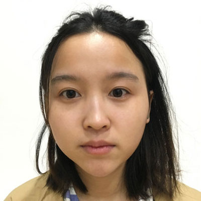 北京画美徐学东隆鼻怎么样?案例_价格