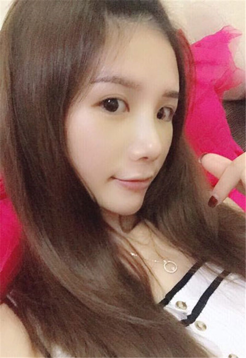 黄惠真隆鼻怎么样?案例_价格