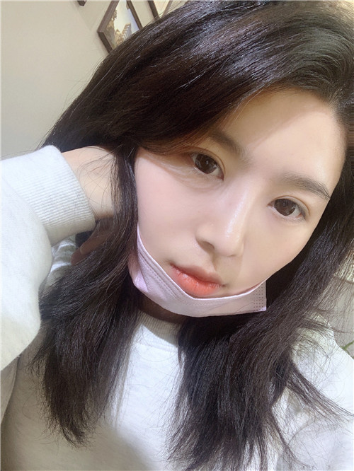 北京美莱王旭东隆鼻怎么样?案例,价格