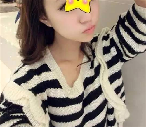 上海伊莱美李湘源丰胸怎么样?案例_价格