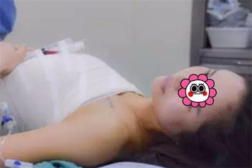 上海伊莱美李湘源丰胸怎么样?案例_价格