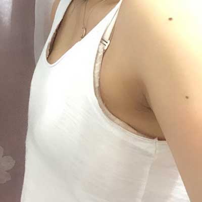 北京美莱董岩岩丰胸怎么样?案例_价格