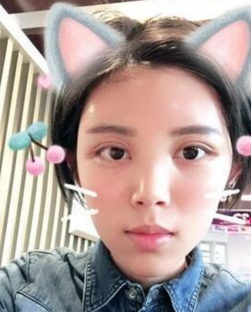 北京韩啸姜辉自体脂肪移植怎么样?案例,价格