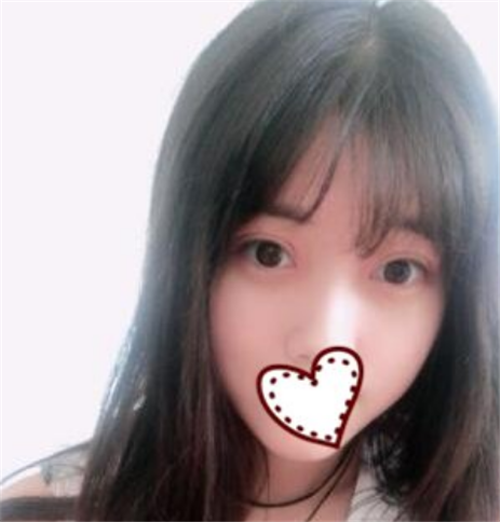 北京爱悦丽格陈波割双眼皮怎么样?案例_价格