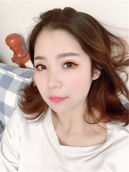 上海艺星杨国正割双眼皮怎么样?案例价格