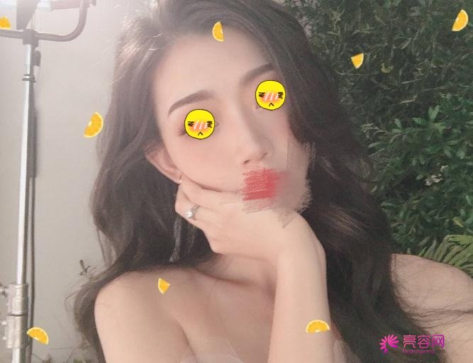芜湖弋矶山整形美容科怎么样？案例_价格_口碑