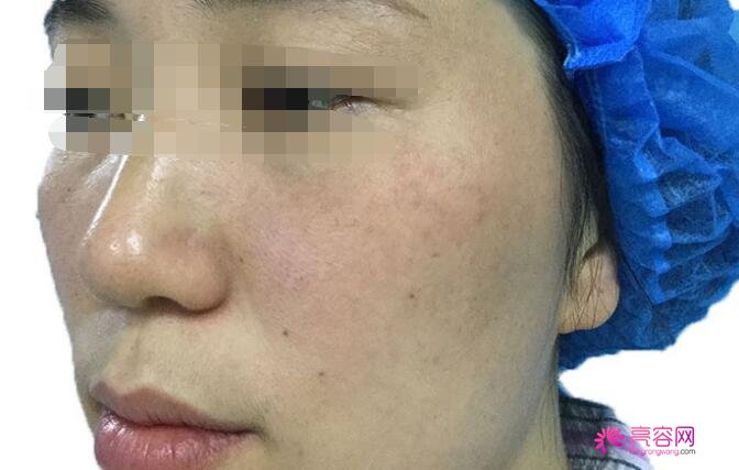 肇庆第一人民医院整形中心口碑好不好呢？做激光美容治疗靠谱吗？
