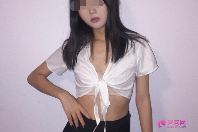 枣庄市立医院整形美容找谁更靠谱呢？附上医生详细+王旭东医生吸脂案例