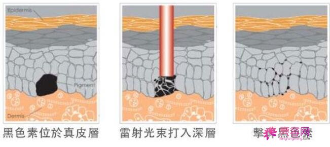 银川第二人民医院皮肤科怎么样呢？医生信息详情|祛斑果前后对比