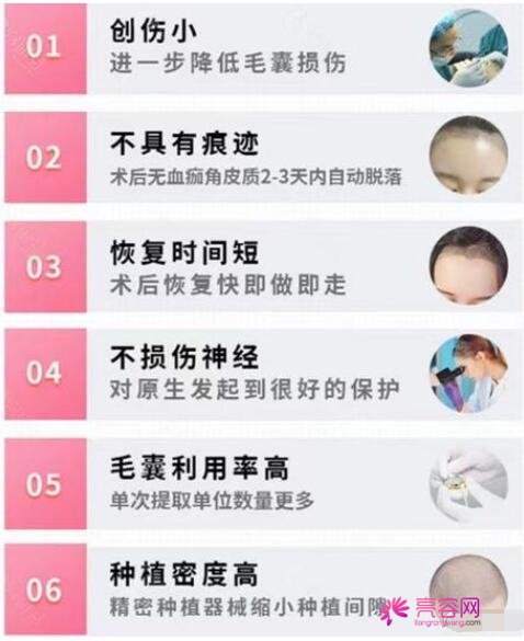 植发的果是否保持不变