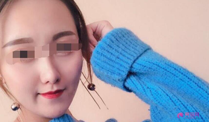 武汉协和医院郭能强医生做隆鼻技术怎么样?案例_价格_口碑