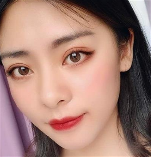 上海艺星黄泽春割双眼皮怎么样?案例_价格