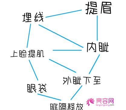 埋线双眼皮优缺点