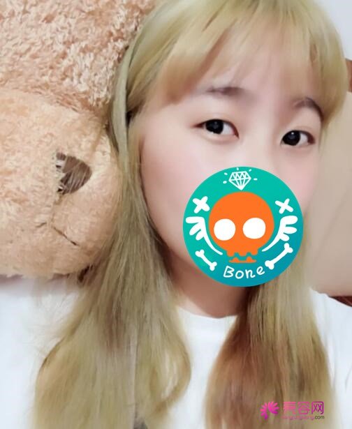 双眼皮手术多少钱一次？价格表2021新版，小仙女割双眼皮案例来啦！