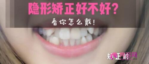 西宁市第三人民医院口腔科价格表，口腔医生信息+牙齿矫正案例分享
