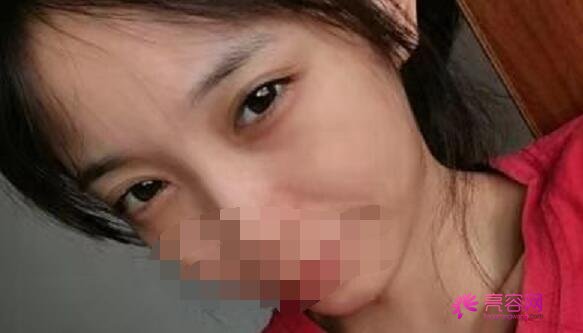 遵义第一人民医院眼科门诊的医疗团队怎么样呢？附上近视矫正案例分享！