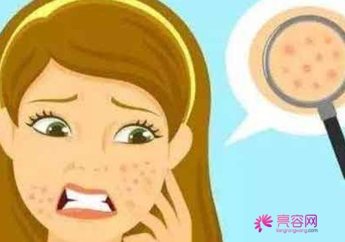 镭射黑脸娃娃果怎么样？镭射黑脸娃娃调节步骤+真人案例分享
